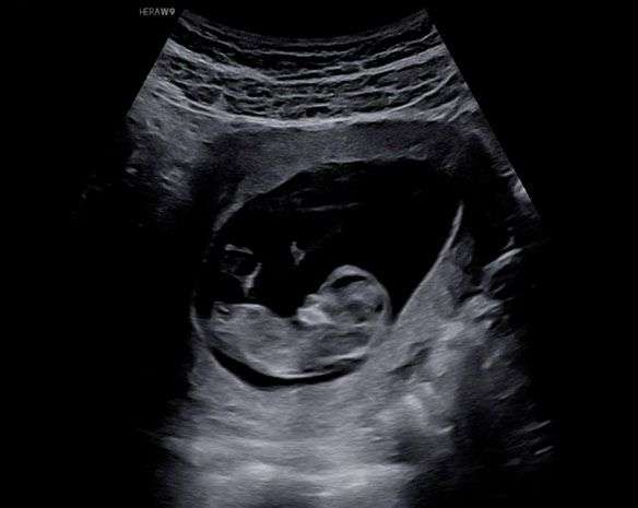 30 weken baby
